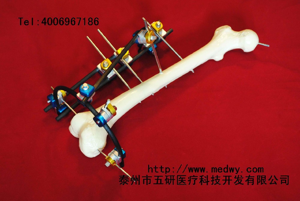 骨折、关节炎与四肢畸形患者福音