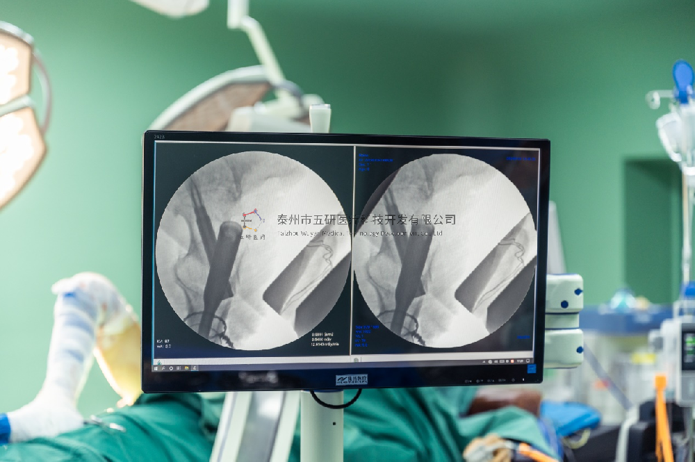 强直性脊柱炎既往病史，股骨粗隆下骨折